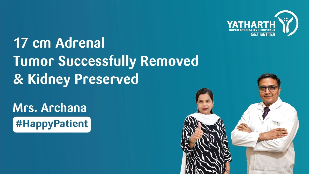 Happy Patient | 17 cm Adrenal Tumor Successfully Removed | Dr. Pragnesh Desai | Yatharth Hospital