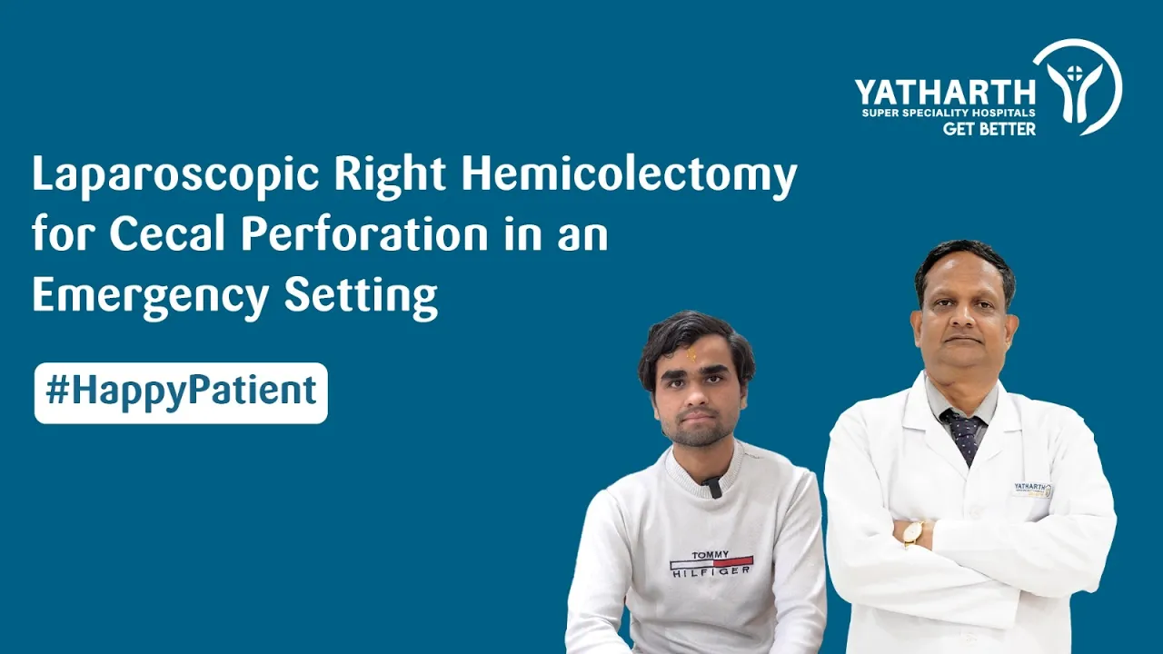 Happy Patient | Laparoscopic Right Hemicolectomy for Cecal Perforation | Dr. Balkishan Gupta