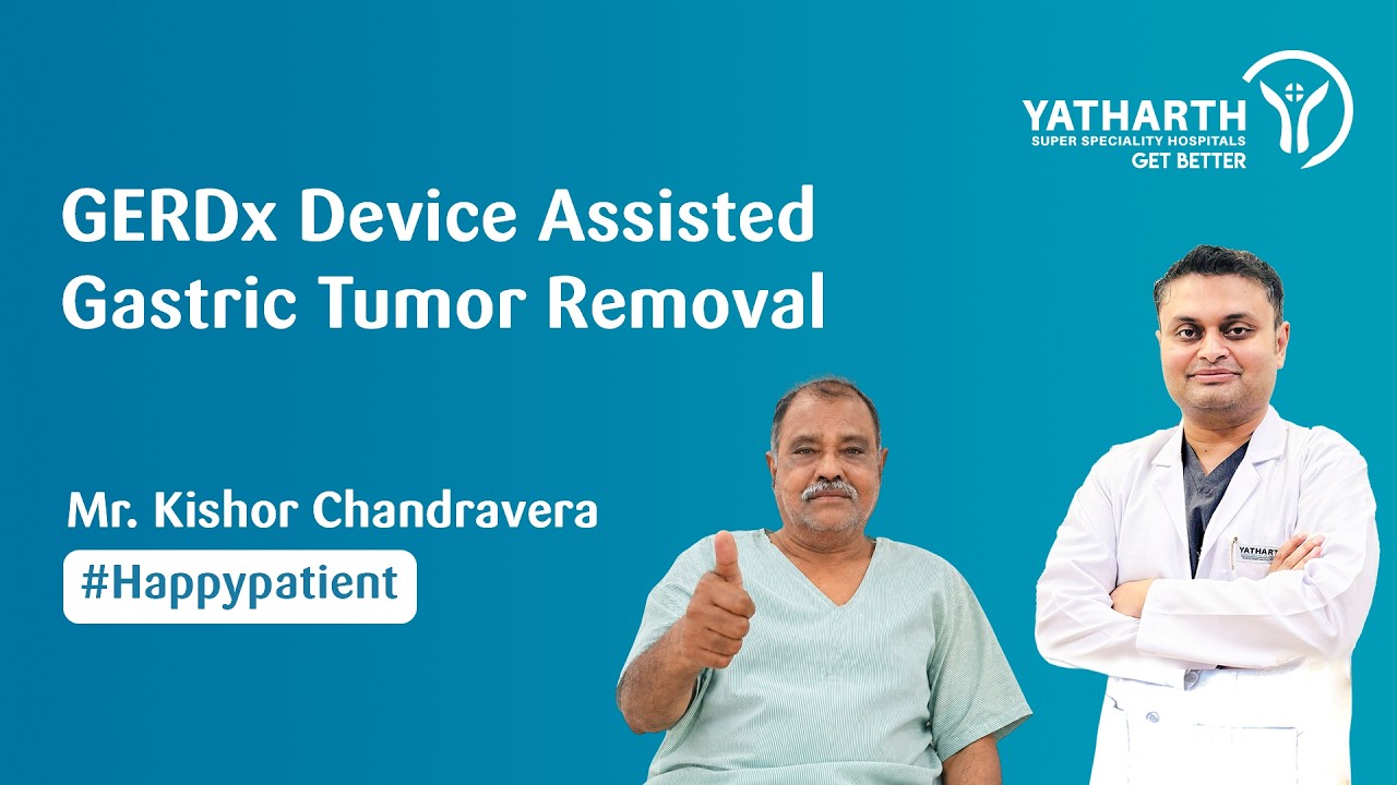 Happy Patient | Successful GERDx Device-Assisted Gastric Tumor Removal | Dr. Dhurv Kant Mishra