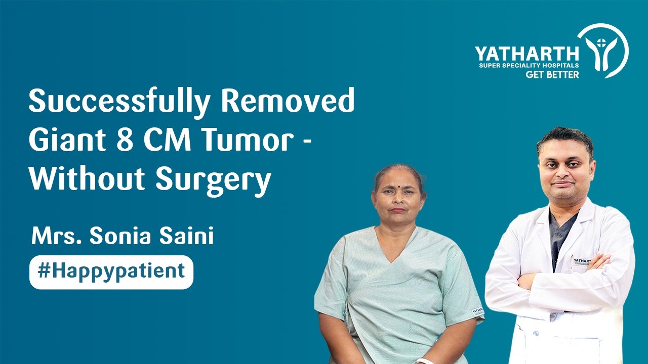 Happy Patient | Successfully Removed a Giant 8 CM Tumor Without Surgery | Dr. Dhruv Kant Mishra