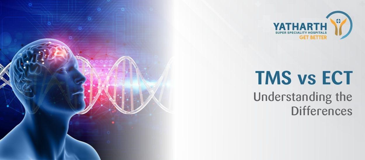 TMS vs. ECT: Understanding the Differences