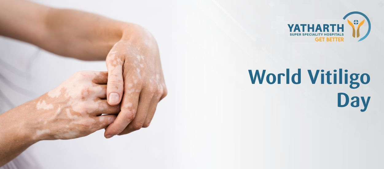 World Vitiligo Day 2026