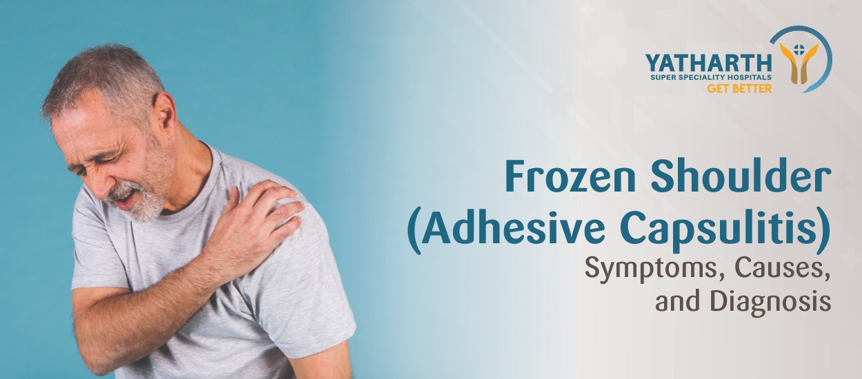 Frozen Shoulder (Adhesive Capsulitis): Symptoms, Causes, and Diagnosis