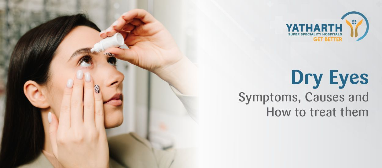 Dry Eyes: Symptoms, Causes & How to Treat Them