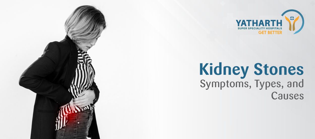 Kidney Stones: Symptoms, Types, and Causes