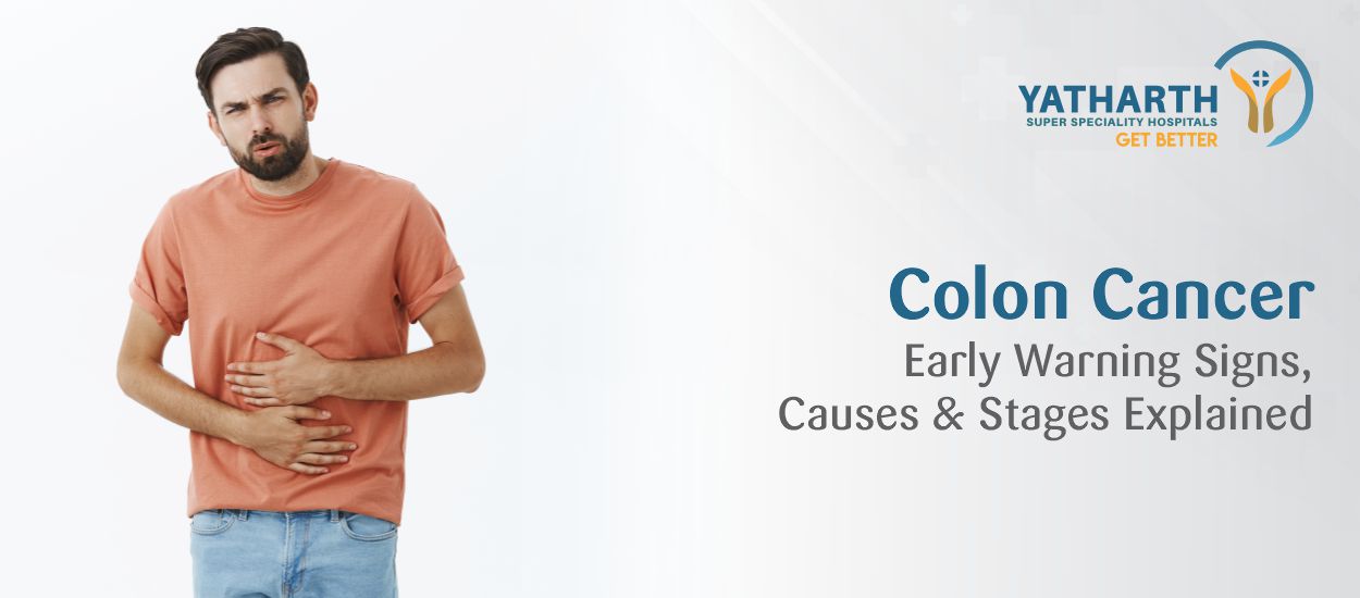 Colon Cancer: Early Warning Signs, Causes & Stages Explained