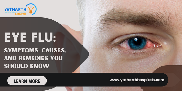 Eye Flu Symptoms Causes and Remedies You Should Know