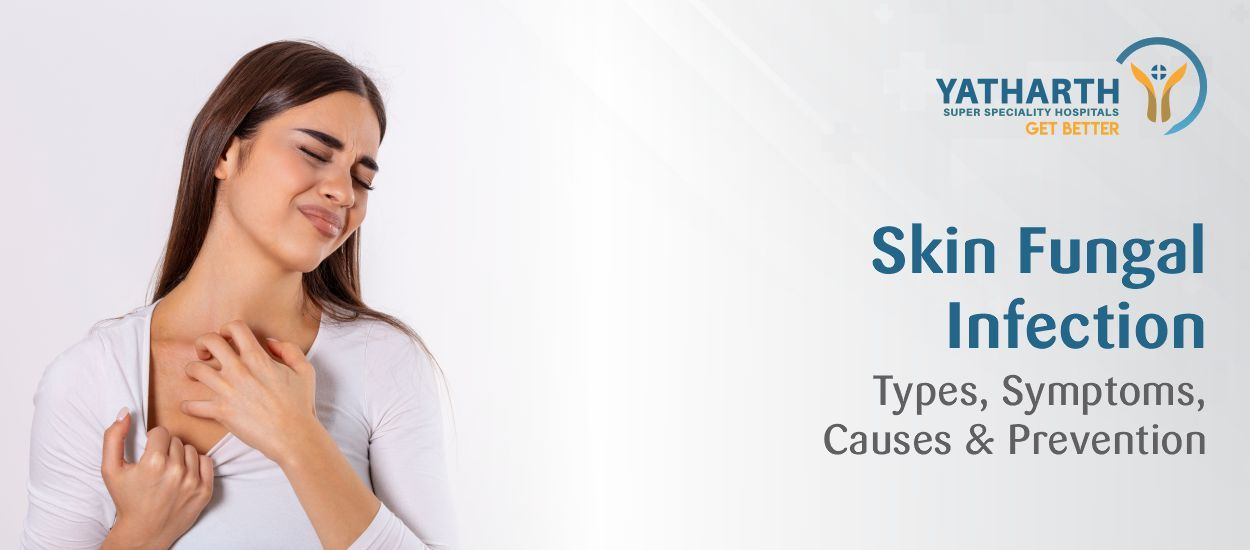 Skin Fungal Infection: Types, Symptoms, Causes, & Prevention