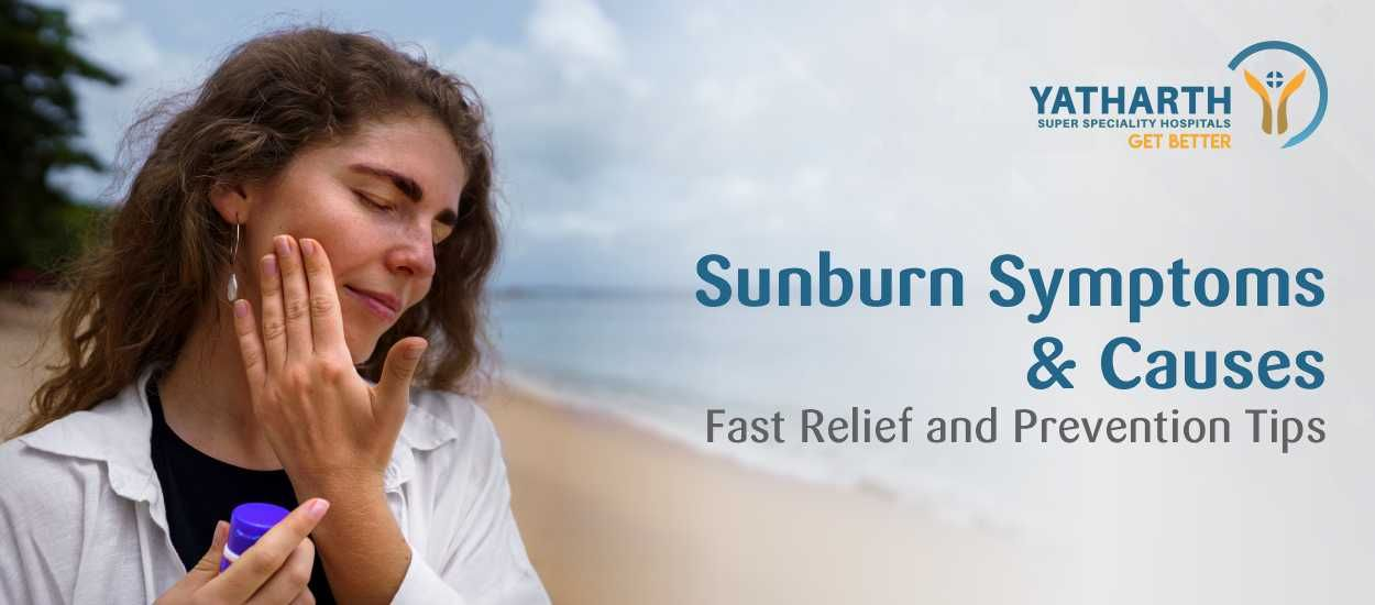 Sunburn Symptoms and Causes: Fast Relief and Prevention Tips