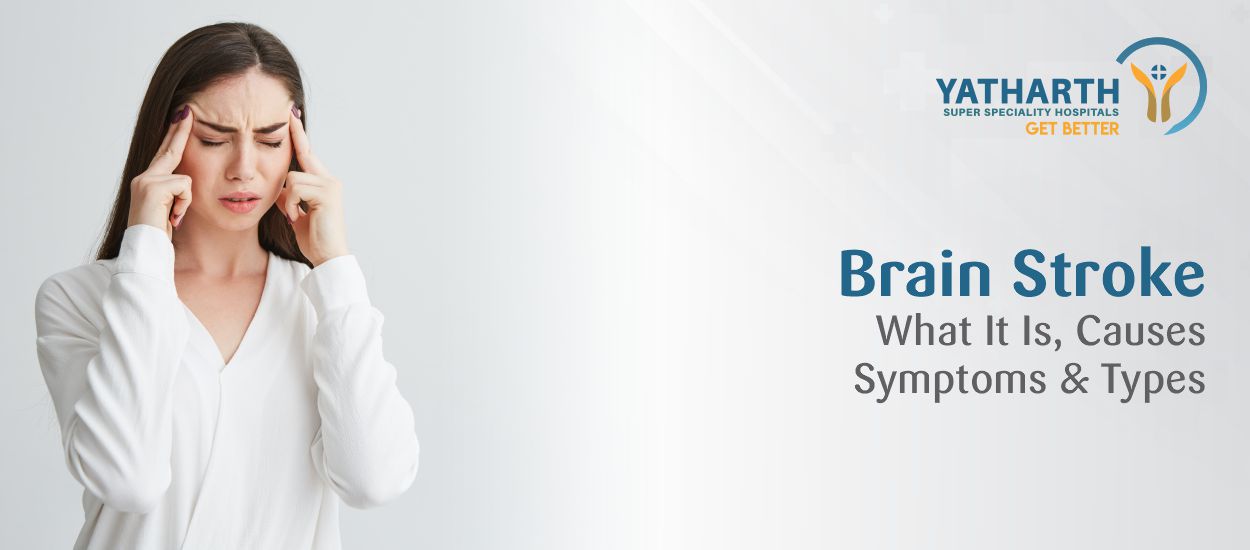 Stroke (Brain Stroke): What It Is, Causes, Symptoms and Types