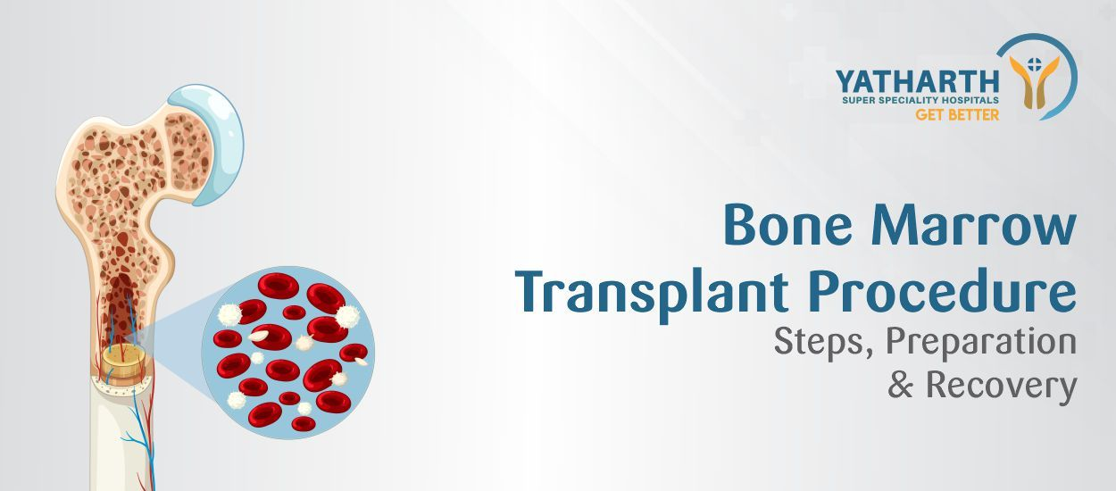 Bone Marrow Transplant Procedure: Steps, Preparation & Recovery
