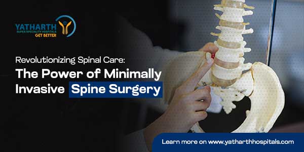 Revolutionizing Spinal Care: The Power of Minimally Invasive Spine Surgery