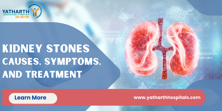 Kidney Stones Symptoms and Treatment Options
