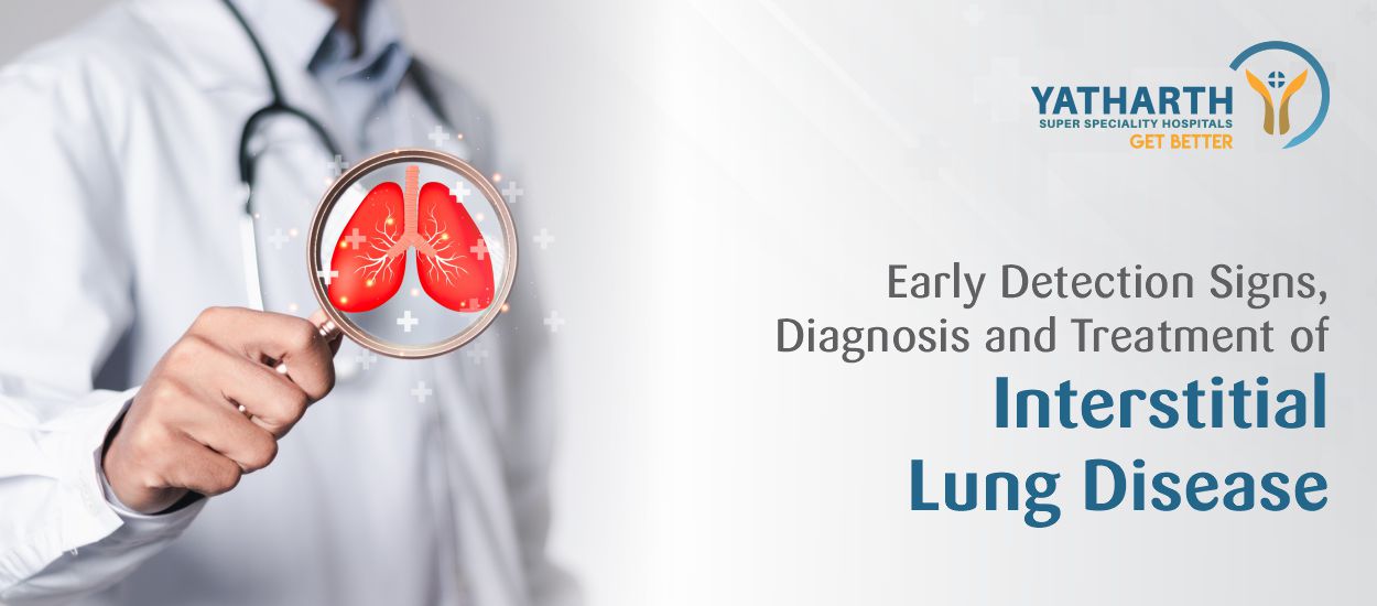 Early Detection Signs, Diagnosis and  Treatment of Interstitial Lung Disease