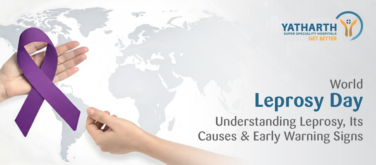 World Leprosy Day 2026: Understanding Leprosy, Its Causes & Early Warning Signs