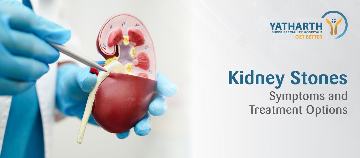 Kidney Stones Symptoms and Treatment Options