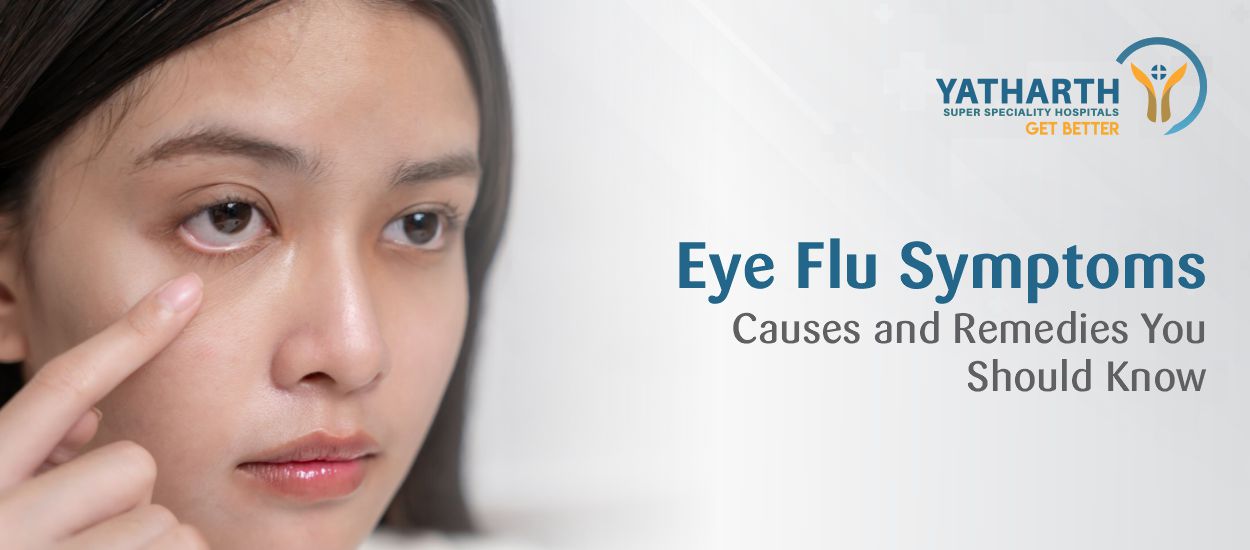 Eye Flu Symptoms Causes and Remedies You Should Know