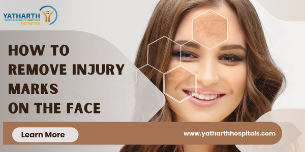 How to remove injury marks on the face