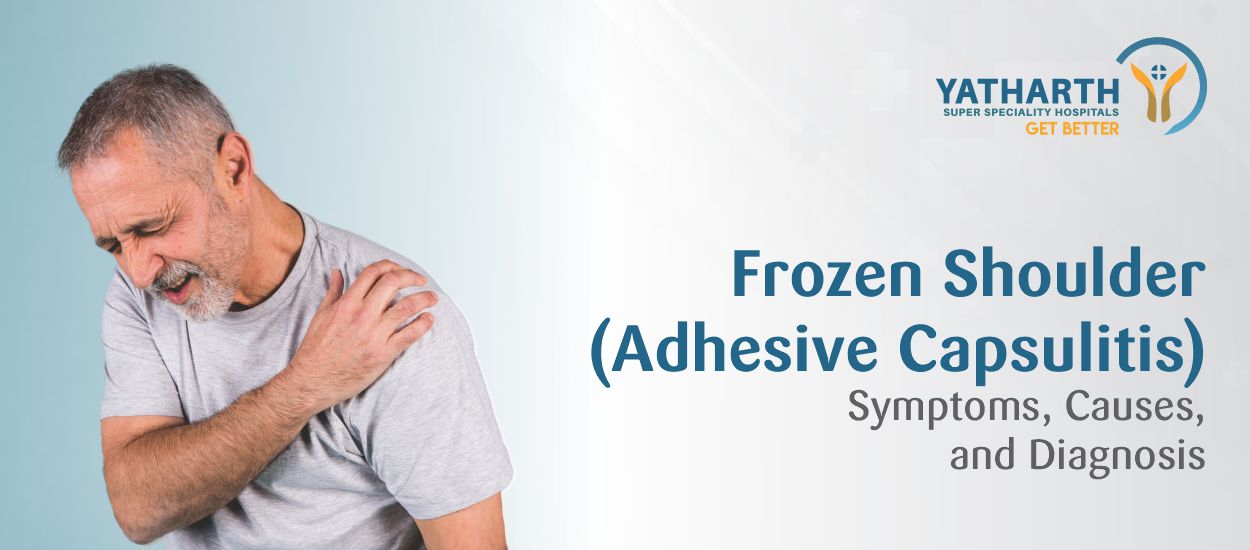 Frozen Shoulder (Adhesive Capsulitis): Symptoms, Causes, and Diagnosis