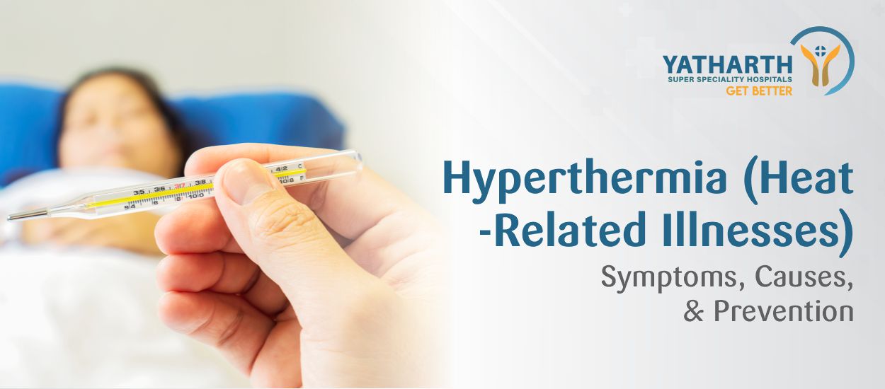 Hyperthermia (Heat-Related Illnesses): Symptoms, Causes, & Prevention