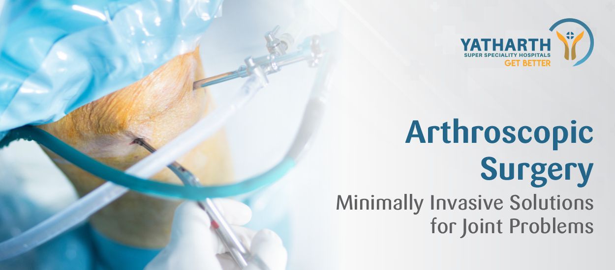 Arthroscopic Surgery:  Minimally Invasive Solutions for Joint Problems