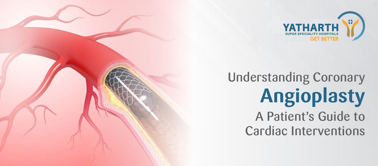 Understanding Coronary Angioplasty and Stenting:  A Patient’s Guide to Cardiac Interventions