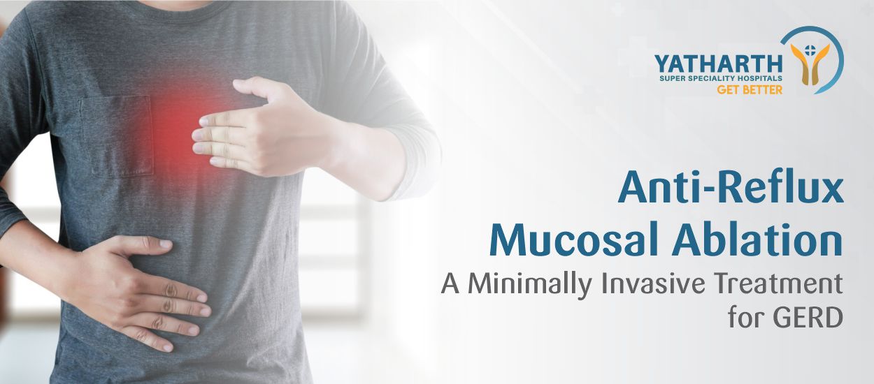 Anti-Reflux Mucosal Ablation:  A Minimally Invasive Treatment for GERD