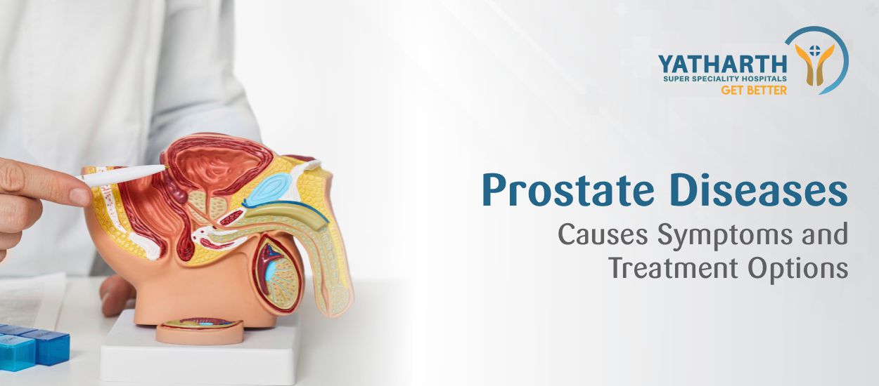 Prostate Medical Problems Prostate Diseases: Causes, Symptoms, and Treatment Options - Yatharth ...